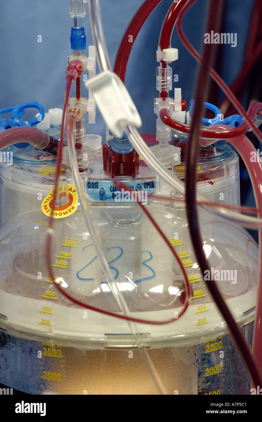 DEU Deutschland Westdeutsches Herzzentrum Essen Klinik fuer Thorax und Kardiovaskulare Chirurgie Herz Lungen Maschine DEU Germania Essen Centro di cuore della Germania Ovest clinica per torace e chirurgia cardiovascolare rianimazione cardiopolmonare WICHTIG Fotos duerfen nicht fuer Werbung PR anderer Kliniken Krankenhaeuser eingesetzt werden Foto Stock