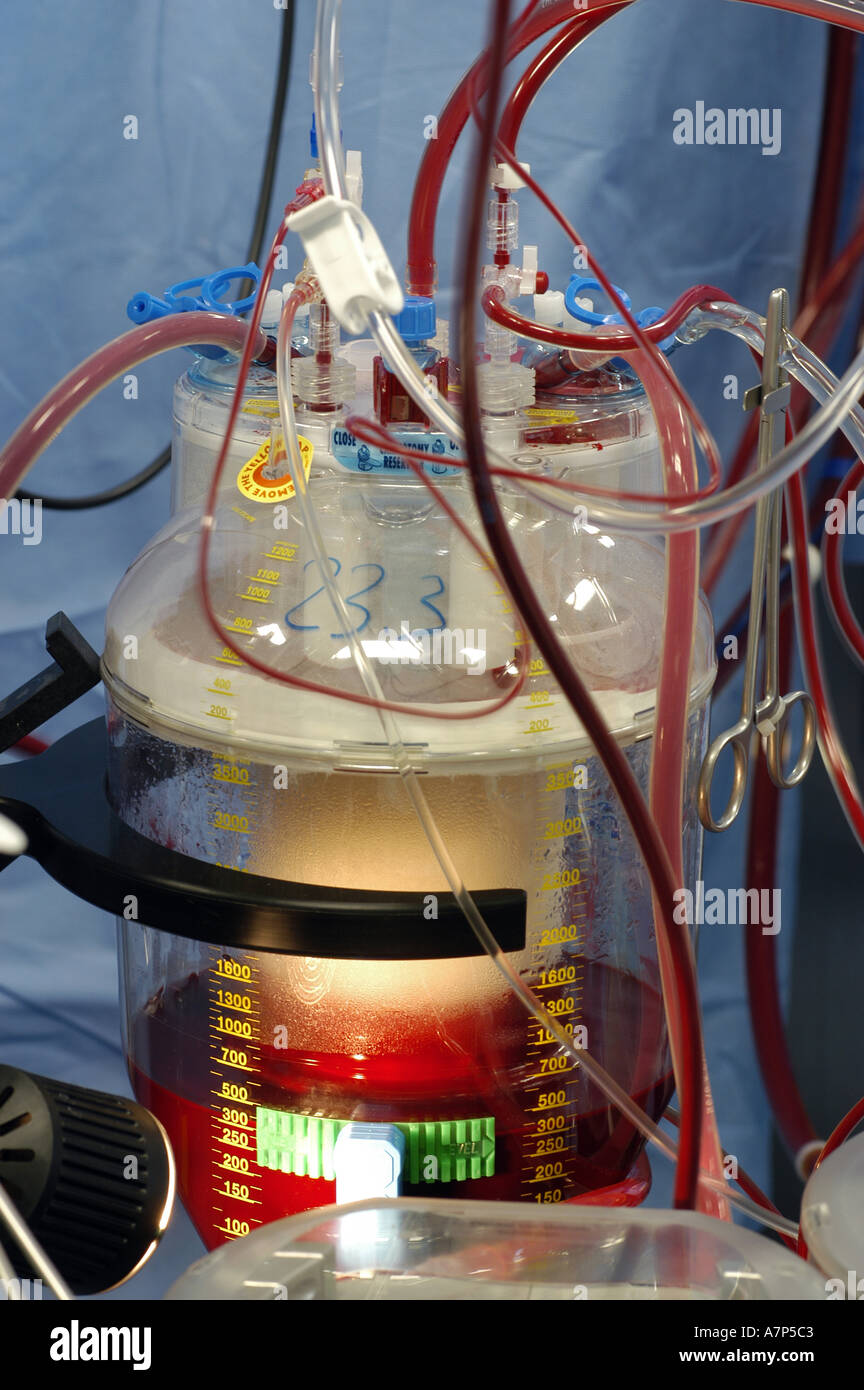 DEU Deutschland Westdeutsches Herzzentrum Essen Klinik fuer Thorax und Kardiovaskulare Chirurgie Herz Lungen Maschine DEU Germania Essen Centro di cuore della Germania Ovest clinica per torace e chirurgia cardiovascolare rianimazione cardiopolmonare WICHTIG Fotos duerfen nicht fuer Werbung PR anderer Kliniken Krankenhaeuser eingesetzt werden Foto Stock