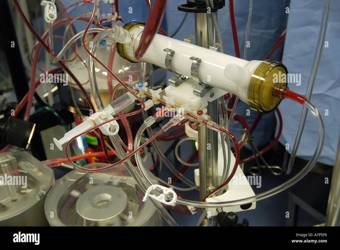 DEU Deutschland Westdeutsches Herzzentrum Essen Klinik fuer Thorax und Kardiovaskulare Chirurgie Herz Lungen Maschine DEU Germania Essen Centro di cuore della Germania Ovest clinica per torace e chirurgia cardiovascolare rianimazione cardiopolmonare WICHTIG Fotos duerfen nicht fuer Werbung PR anderer Kliniken Krankenhaeuser eingesetzt werden Foto Stock