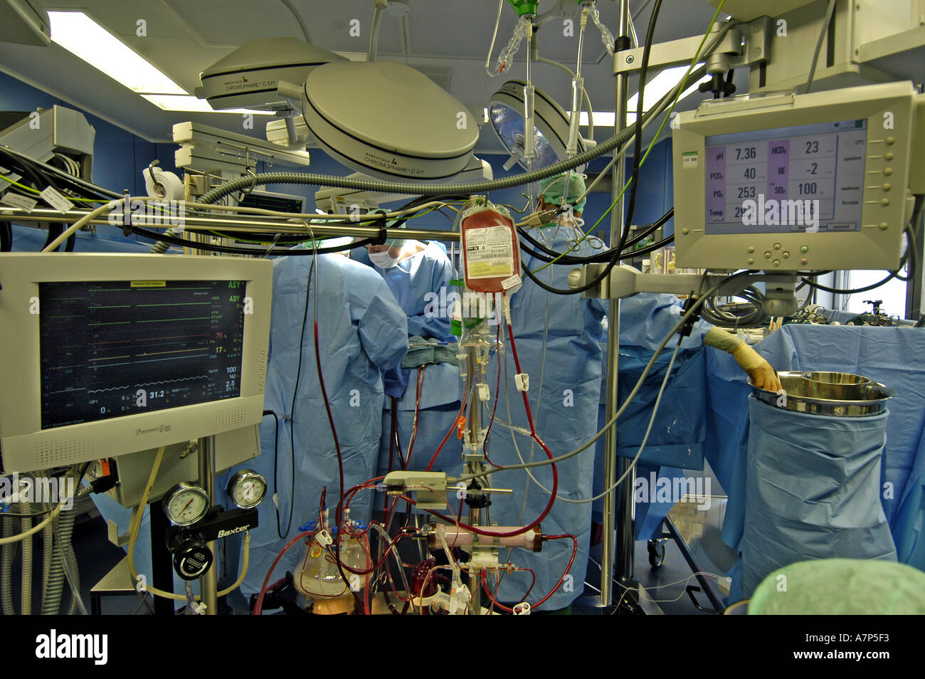 DEU Deutschland Westdeutsches Herzzentrum Essen Klinik fuer Thorax und Kardiovaskulare Chirurgie Herz Lungen Maschine DEU Germania Essen Centro di cuore della Germania Ovest clinica per torace e chirurgia cardiovascolare rianimazione cardiopolmonare WICHTIG Fotos duerfen nicht fuer Werbung PR anderer Kliniken Krankenhaeuser eingesetzt werden Foto Stock