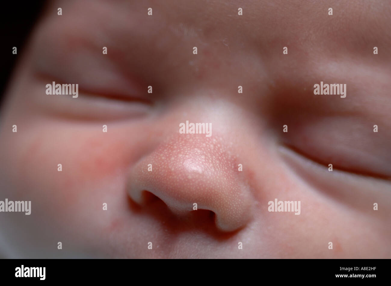 Macchie di latte o milia sul bambino del naso Foto Stock