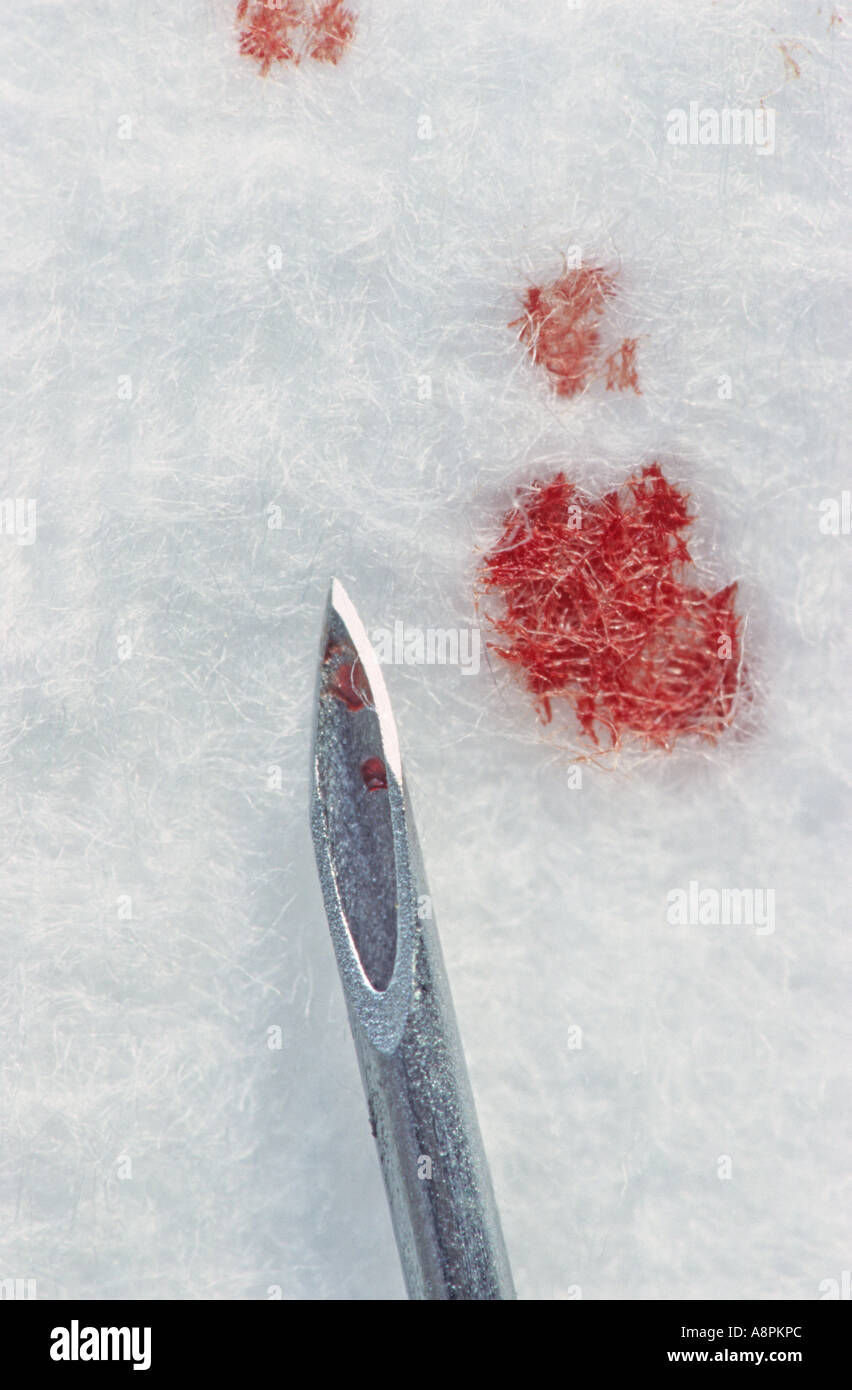 Un usato monovette ago con sangue fresco su un macchiato il tampone di cotone Foto Stock