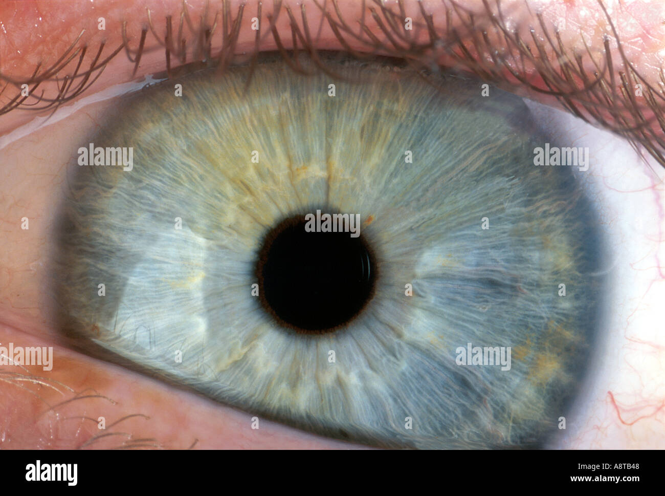 Occhio umano non dilatata Foto Stock