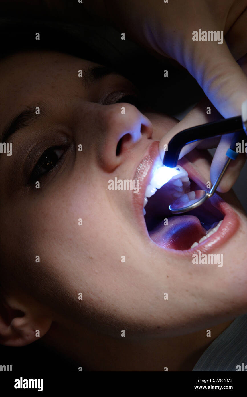 Il trattamento medico del dentista - Behandlung beim Zahnarzt Foto Stock