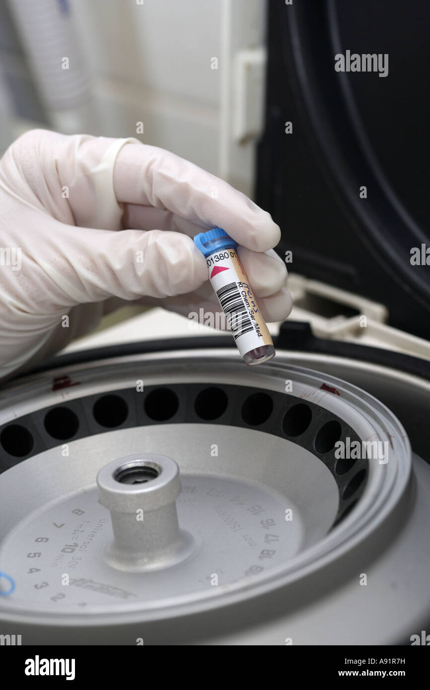 Centrifuga per la separazione dei componenti del sangue Foto Stock