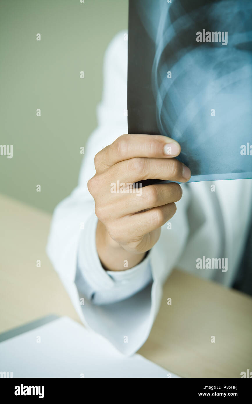 Medico tenendo premuto fino x-ray della gabbia toracica, vista parziale Foto Stock