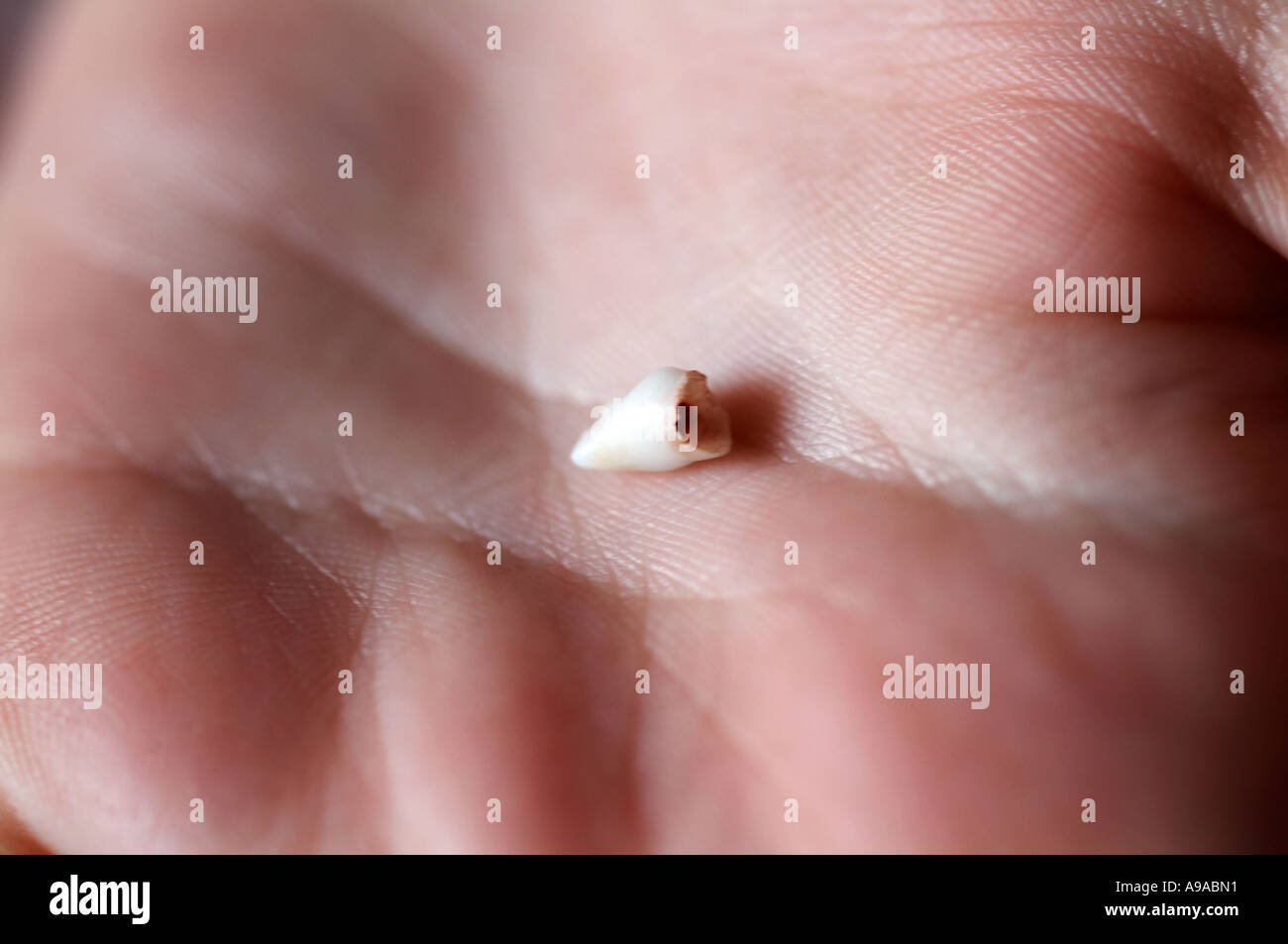 Bambino Baby, dente vicino, fino Foto Stock