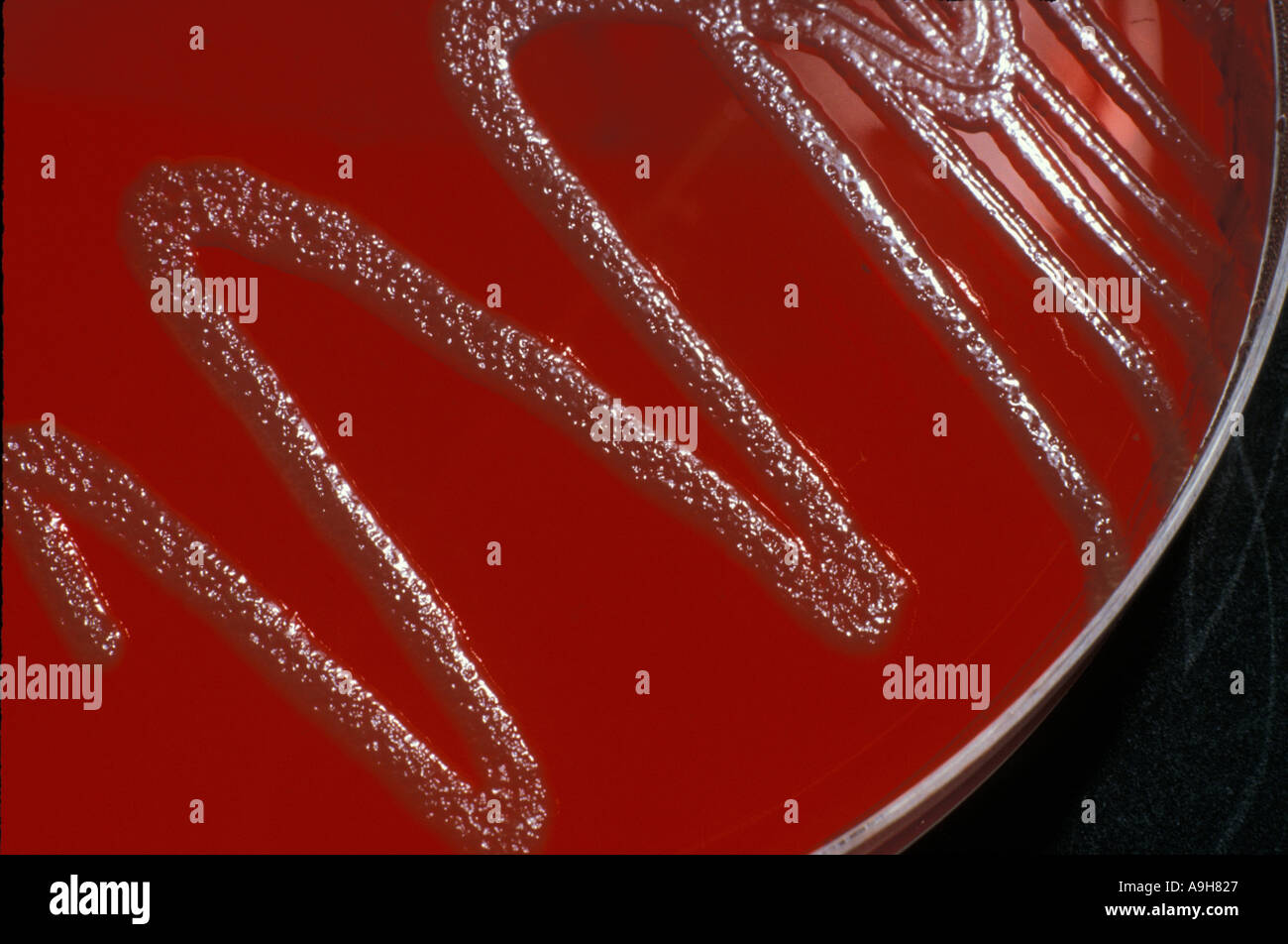 Scientific batteri Escherichia coli le colonie cresciute su agar 1 95 4 22 Foto Stock