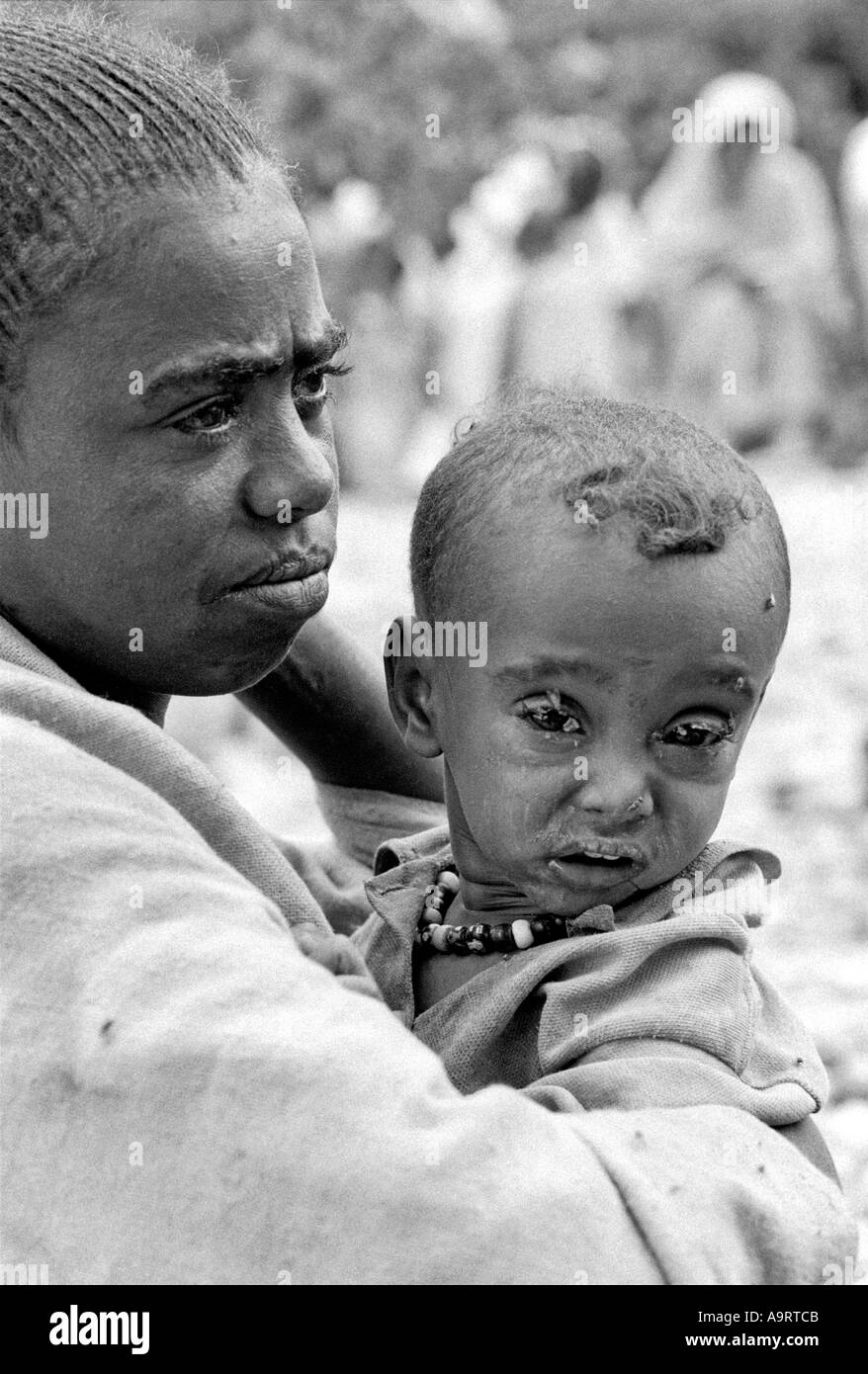 Ritratto B/N di una donna rurale che porta il suo bambino che soffre di tracoma, una malattia trasmessa dalle mosche. Tigray, Etiopia, Africa Foto Stock