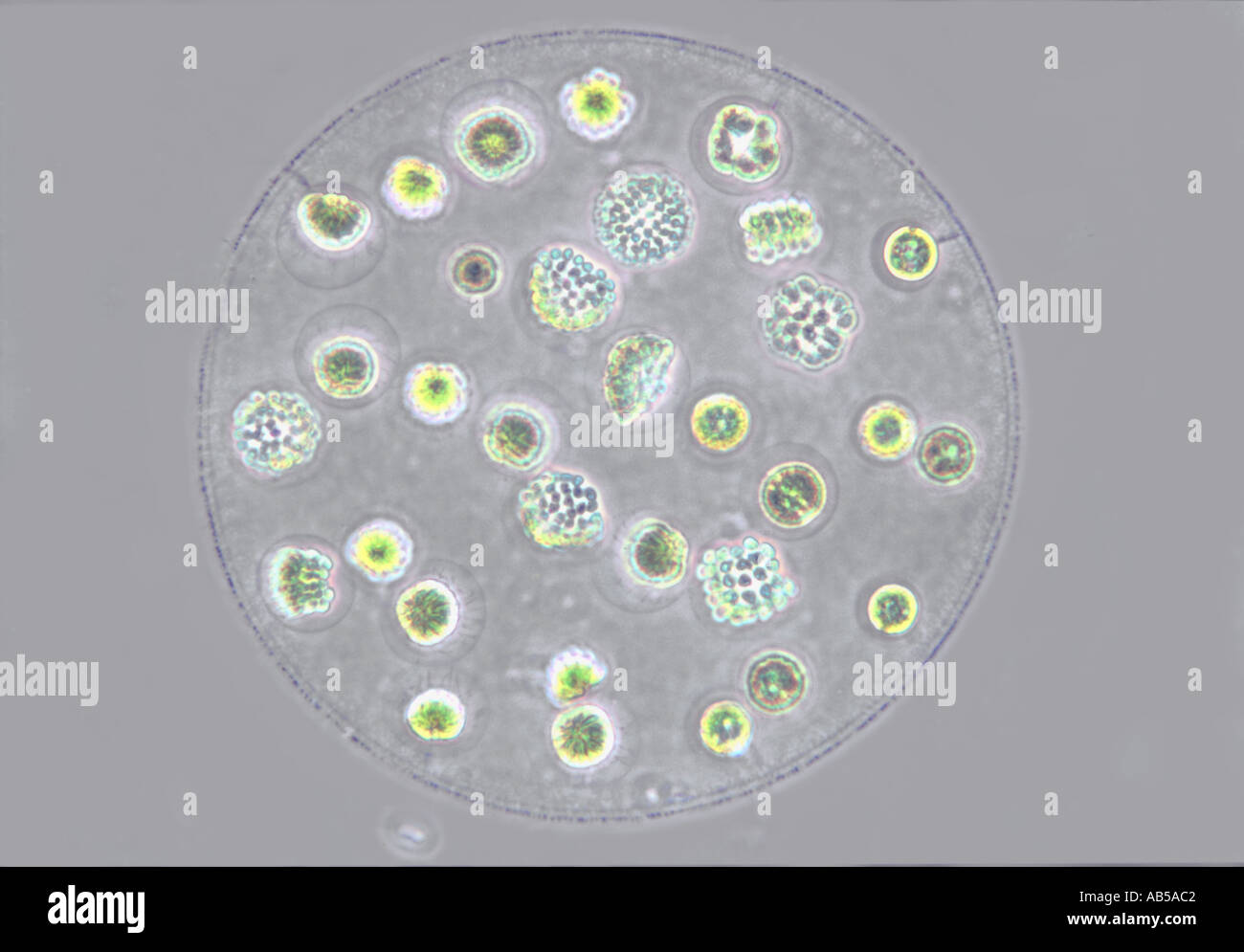 Eudorina colony in fase di riproduzione asessuale vivere il contrasto di fase di flash Foto Stock