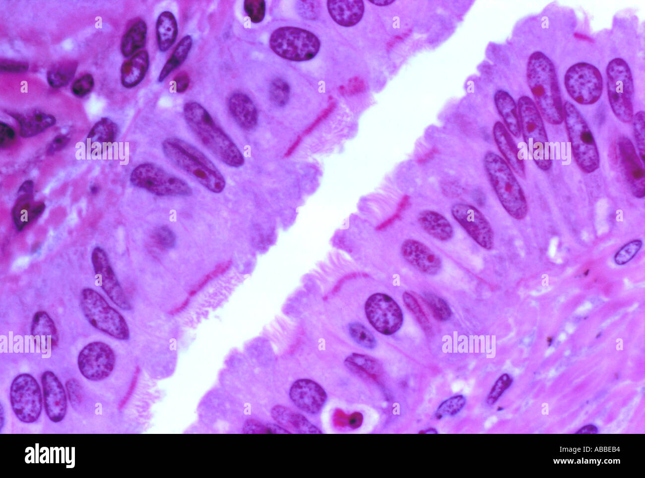 Tubo di Falloppio Semithin sezione di epitelio ciliate colorate in campo chiaro Foto Stock