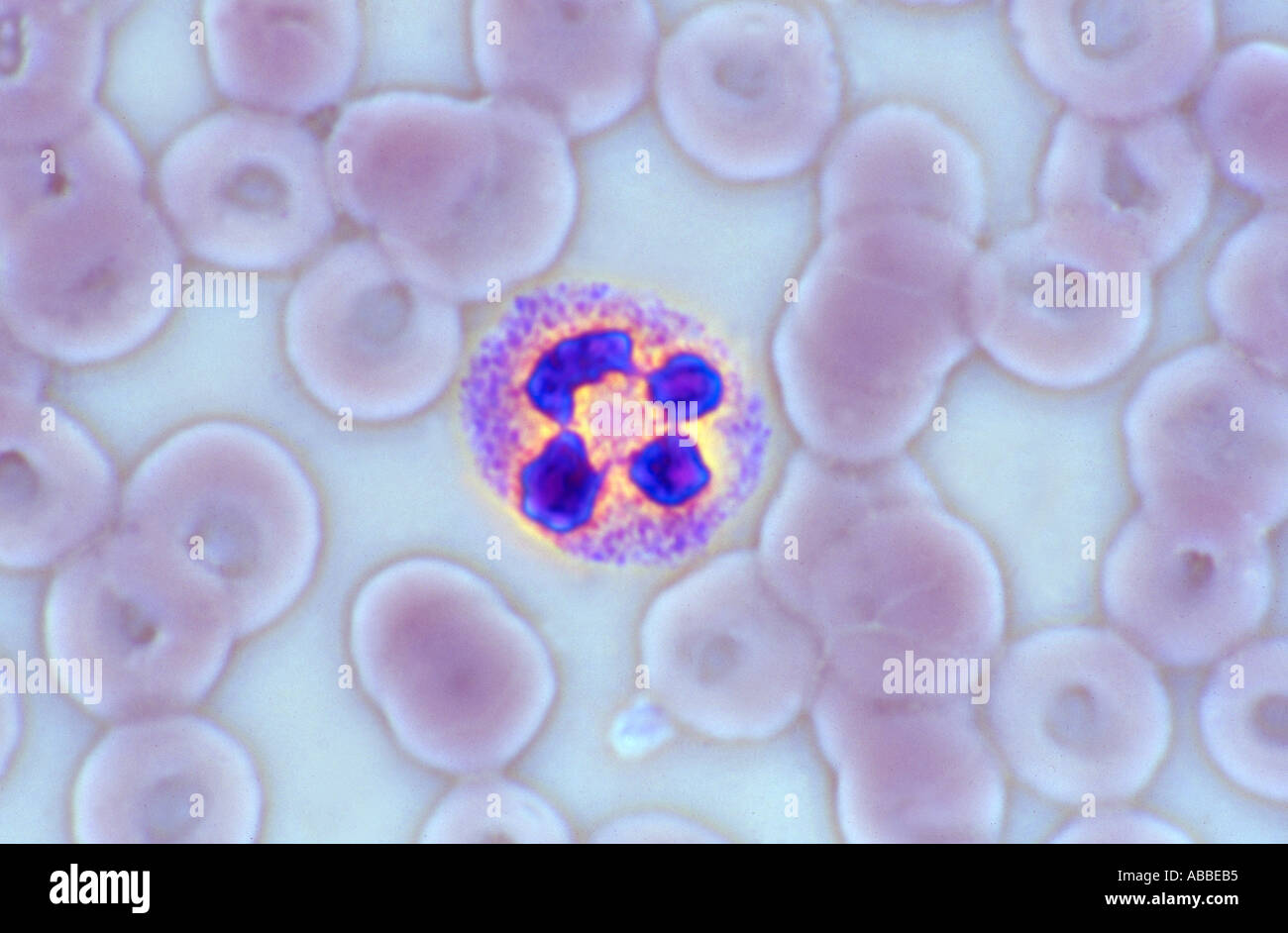 Sangue periferico umano cospargere di mostrare i neutrofili polimorfi colorate a contrasto di fase HFW 60um Foto Stock