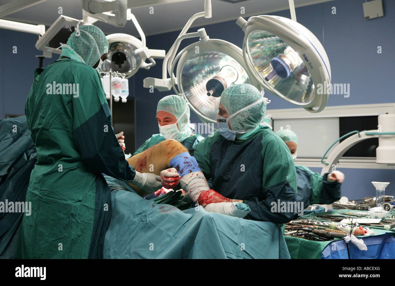DEU Germania operazione chirurgica di una articolazione artificiale dell'anca Foto Stock