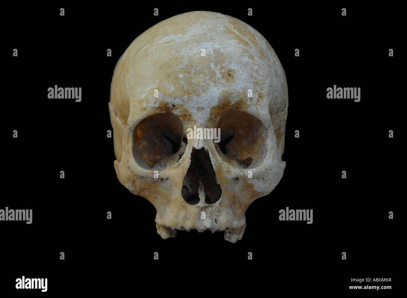 Cranio umano, ritaglio Foto Stock