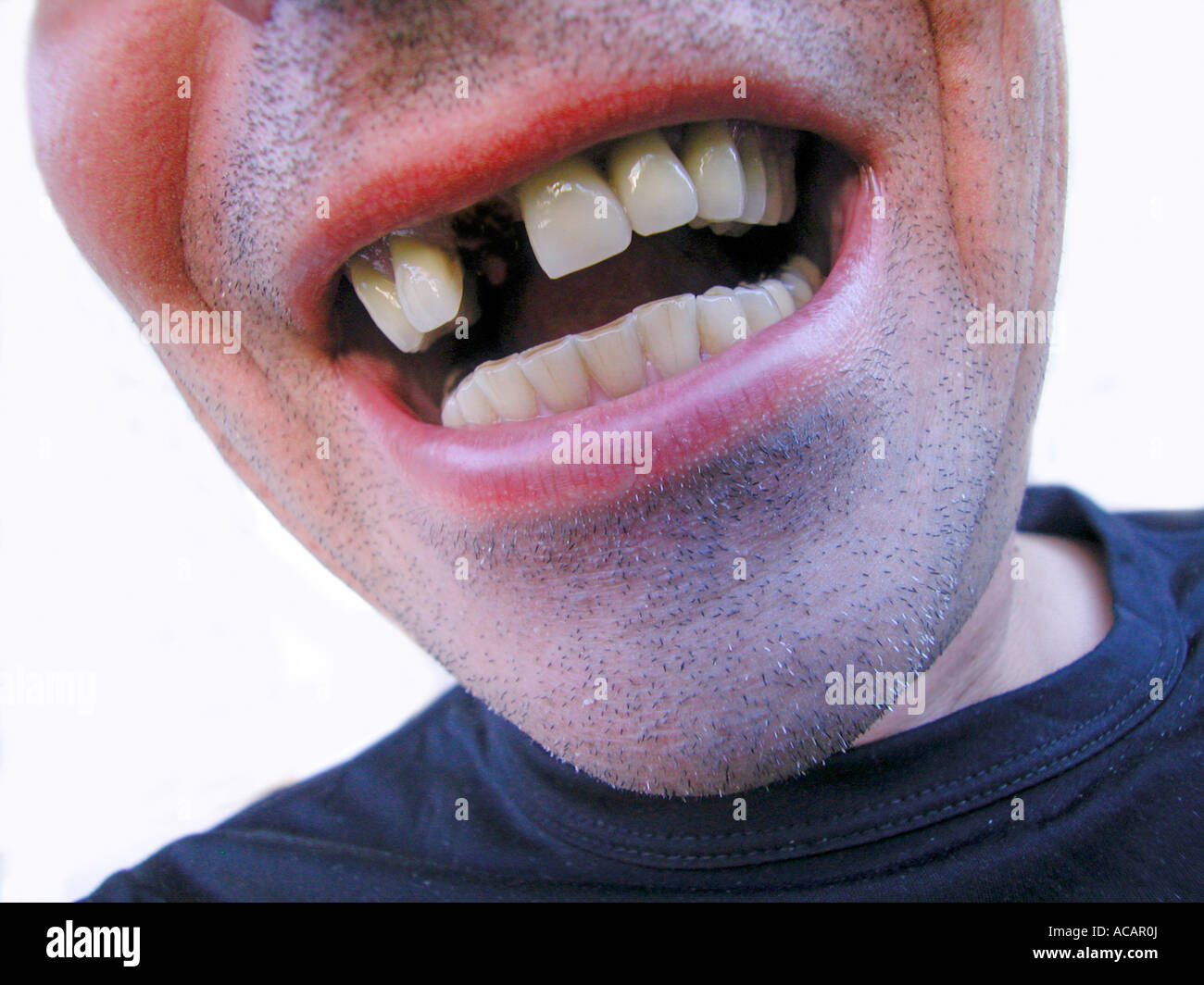 Uomo con un dente divario Foto Stock