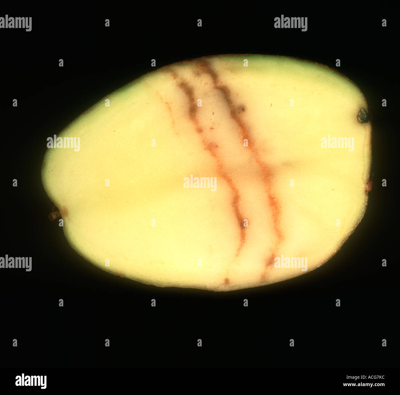 Spraing sintomo della fecola di patate mop top virus PMTV nella patata tubero sezione Foto Stock