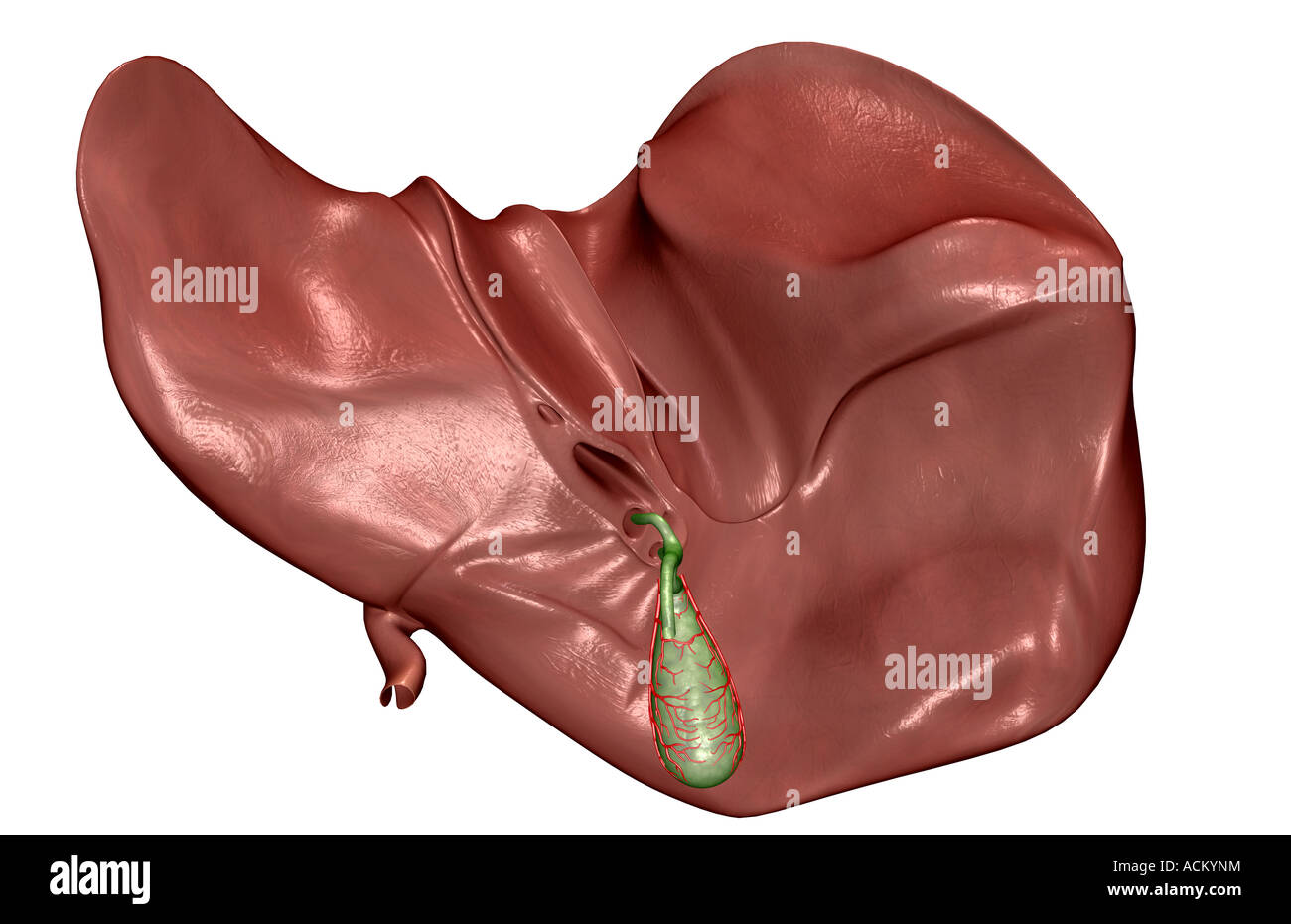 Calcolosi Della Colecisti E Della Via Biliare Sice Italia