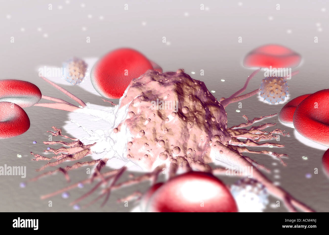 Metastasi Foto Stock