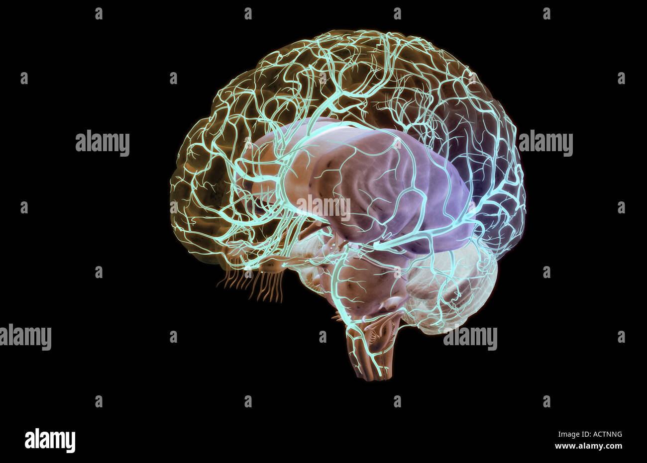 Arterie cerebrali Foto Stock