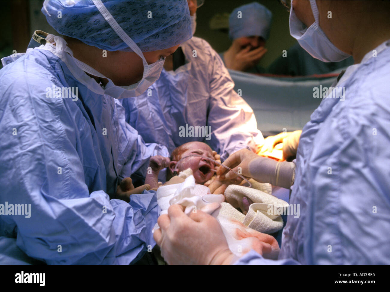 Neonato venga aspirato dopo l'esecuzione del taglio cesareo. Foto Stock
