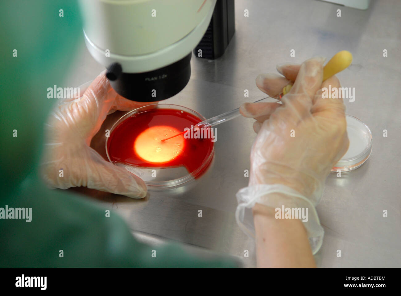 Embryologist immissione embrione in un piatto di coltura durante la vetrificazione del processo presso la clinica di fertilità in Sheba Medical Center di Tel Hashomer, Israele Foto Stock