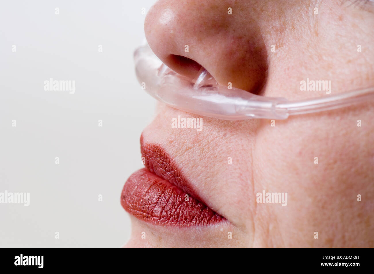 Giovane donna con ossigeno cannula nasale nel suo naso in ospedale Foto Stock