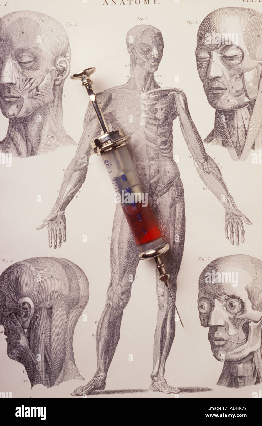 Siringa sul Illustrazione medica Foto Stock