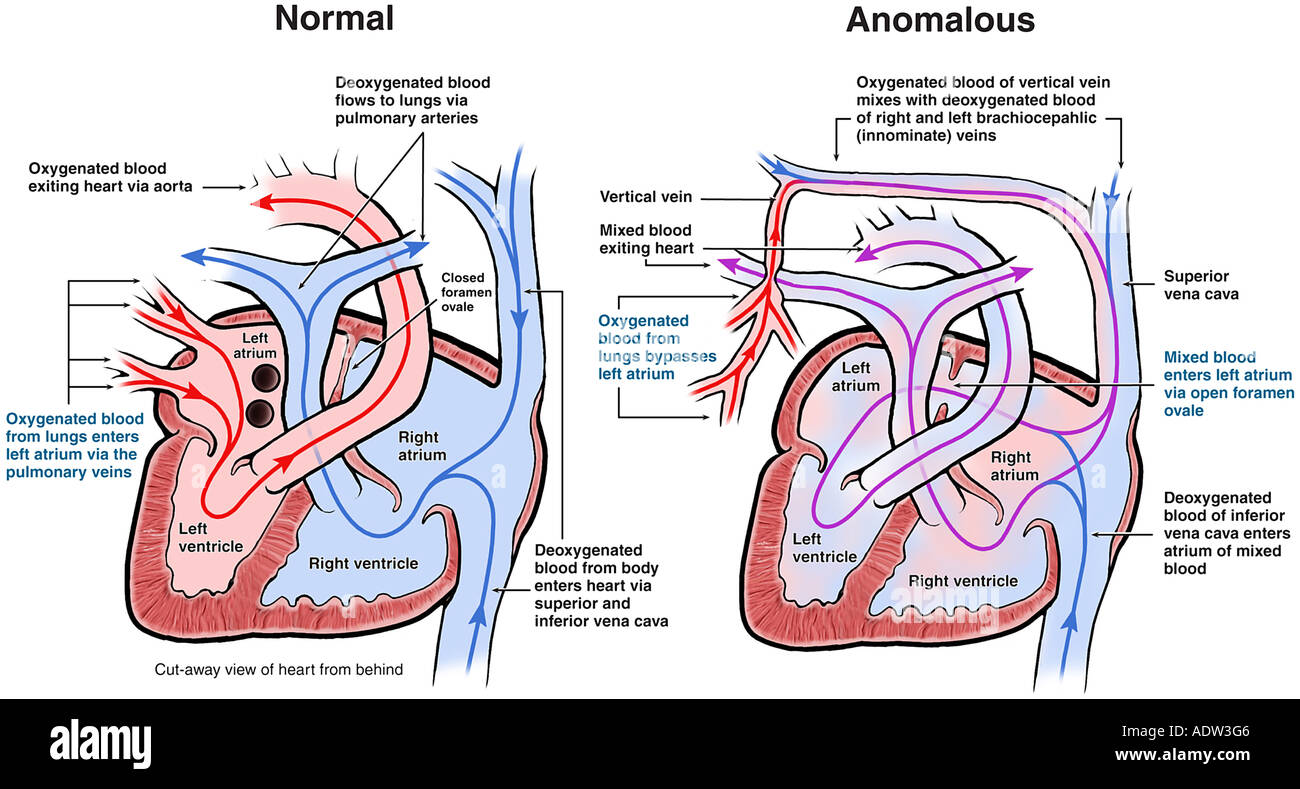 Schema comparativo del flusso sanguigno del cuore Foto Stock