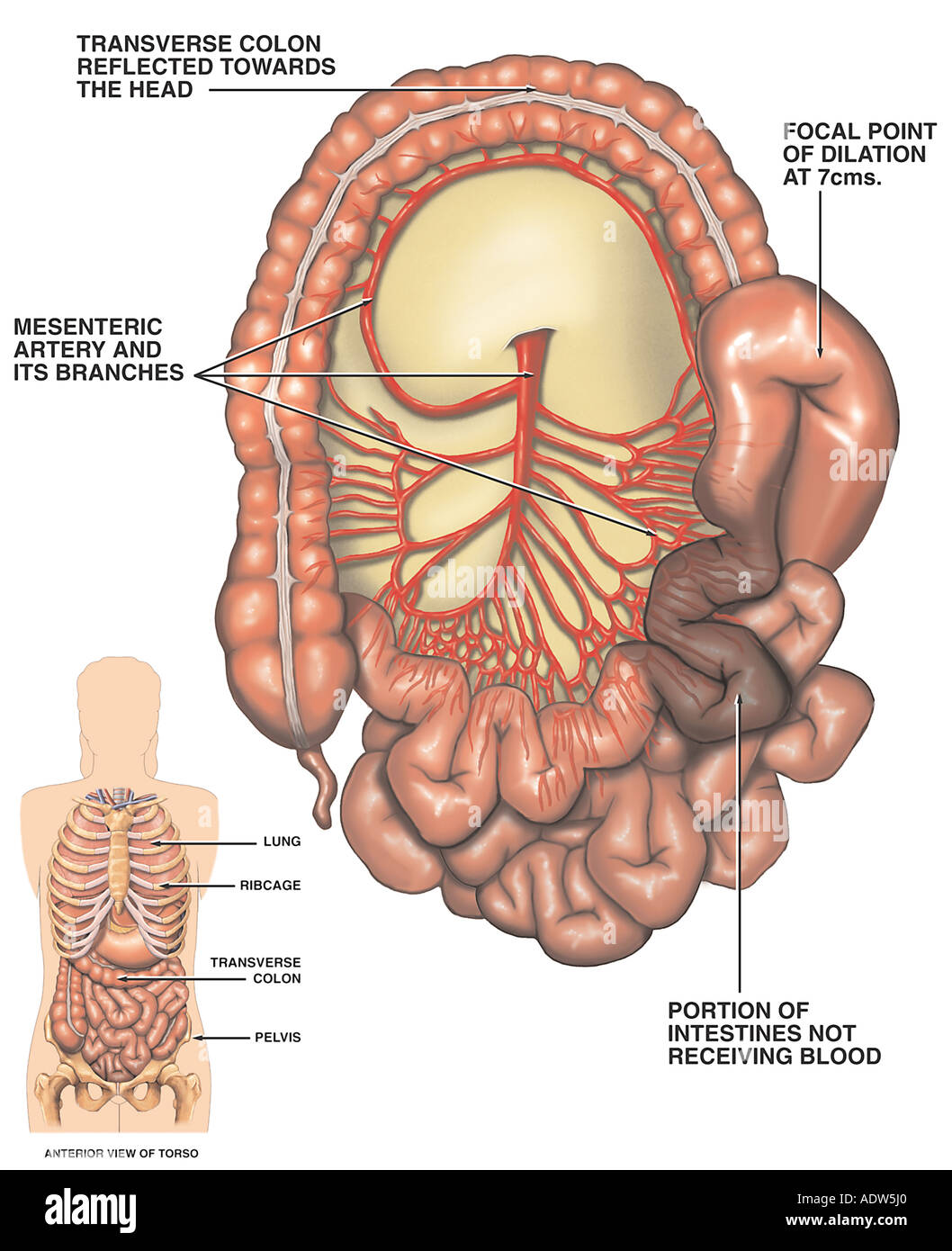 Arteria mesentere superiore immagini e fotografie stock ad alta