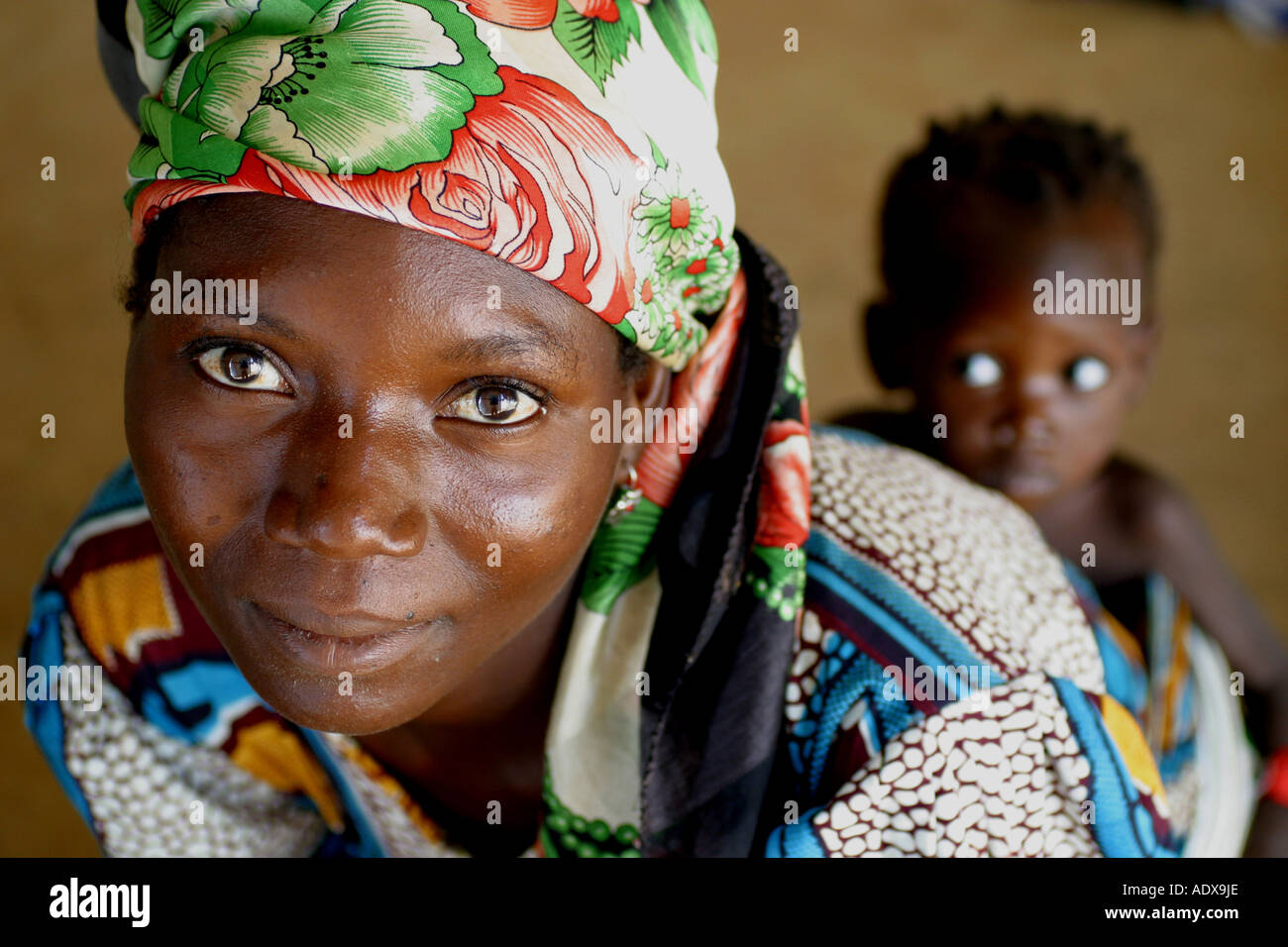 Nel nord della Nigeria vi è elevato livello di malnutrizione grave tra la popolazione Foto Stock