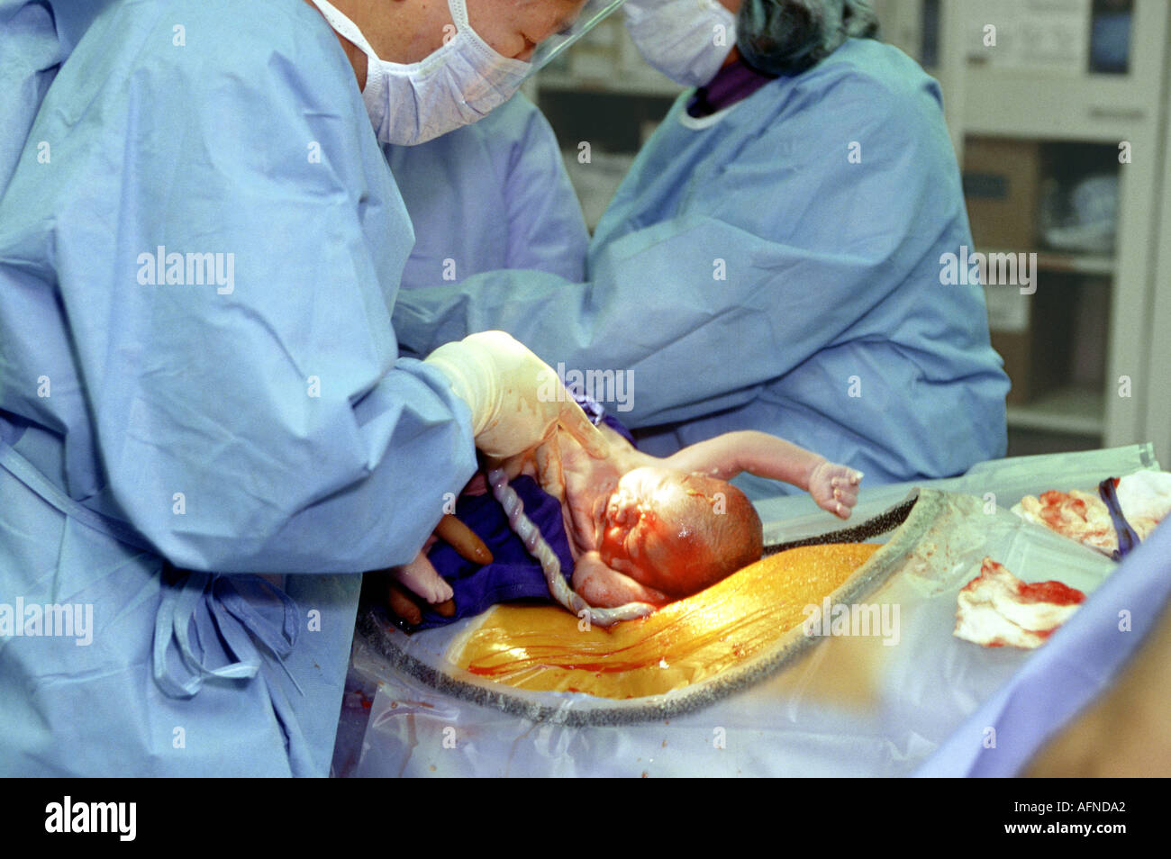 I medici in una sala operatoria eseguire un taglio cesareo nascita su una donna in stato di gravidanza Foto Stock