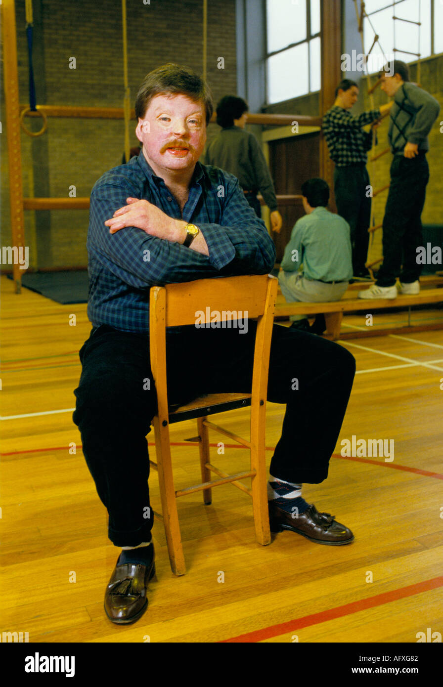 Simon Weston ritratto Falklands eroe vittima di guerra. 1988 creare operazione Weston Spirit con giovane svantaggio anni 80 Liverpool UK HOMER SYKES Foto Stock