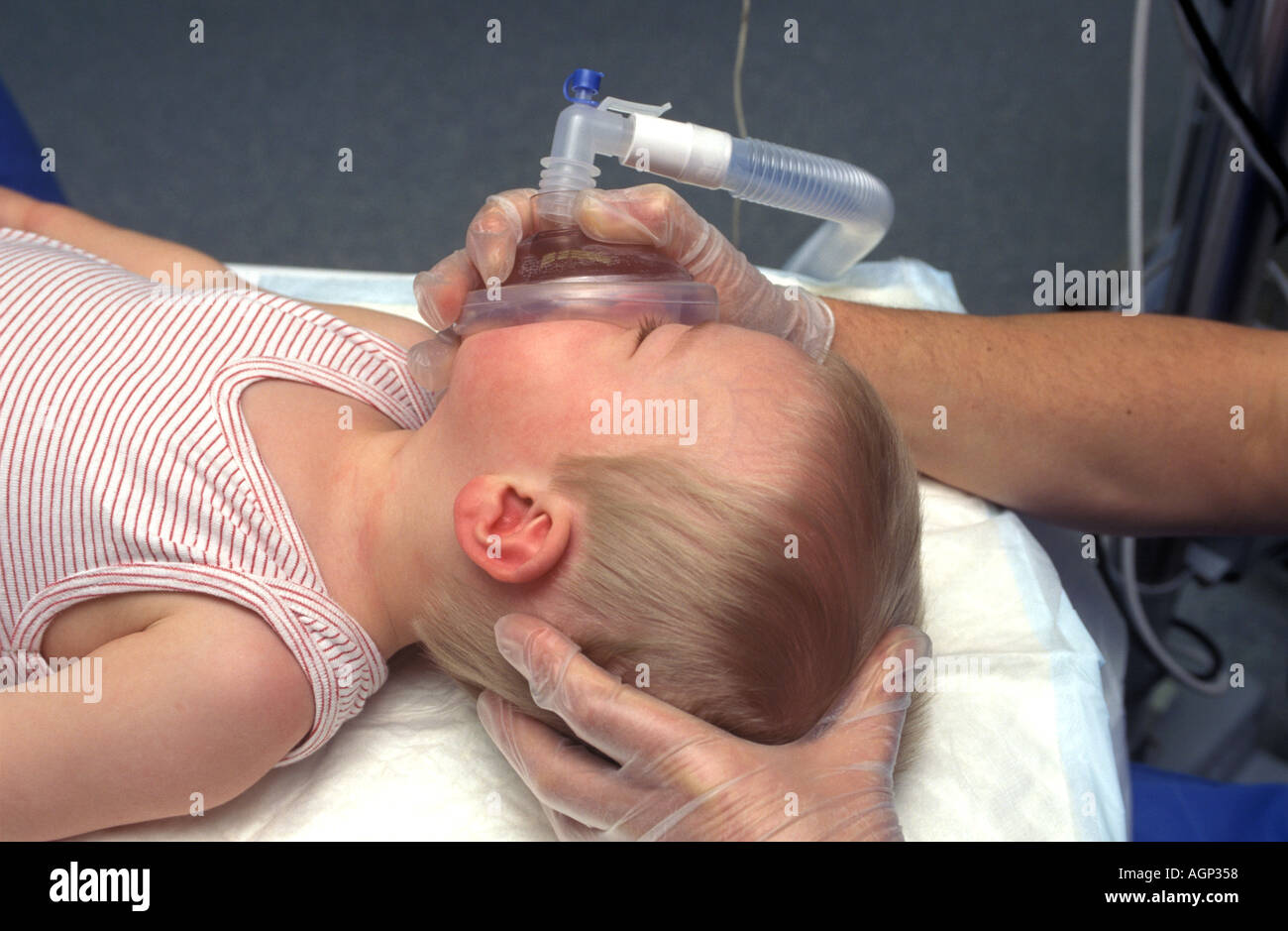 Bambino con maschera di ossigeno per anestesia Foto Stock