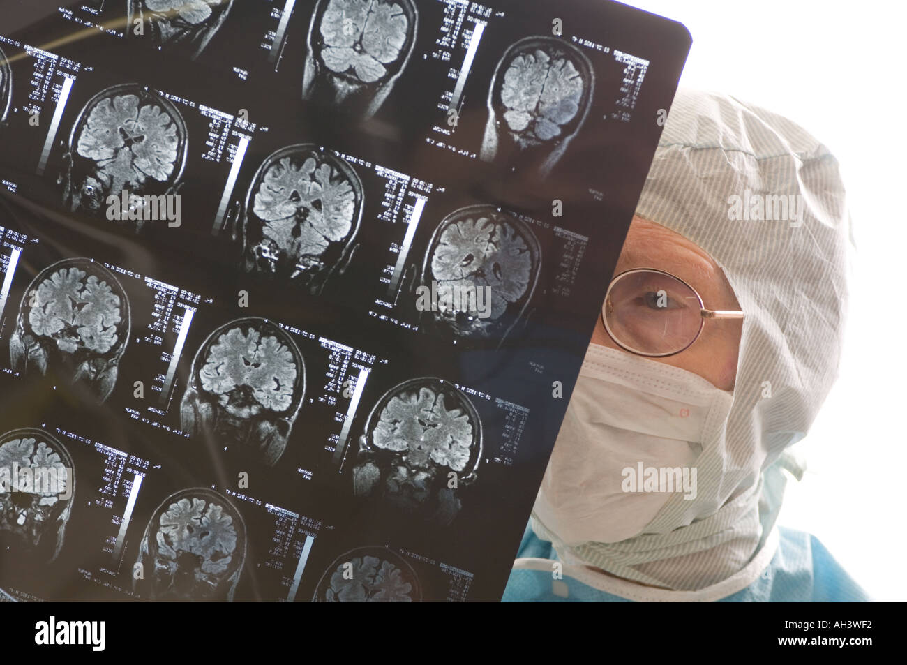 Tecnico femminile esaminando i raggi x della corteccia cerebrale di cervelletto di cervello umano Foto Stock