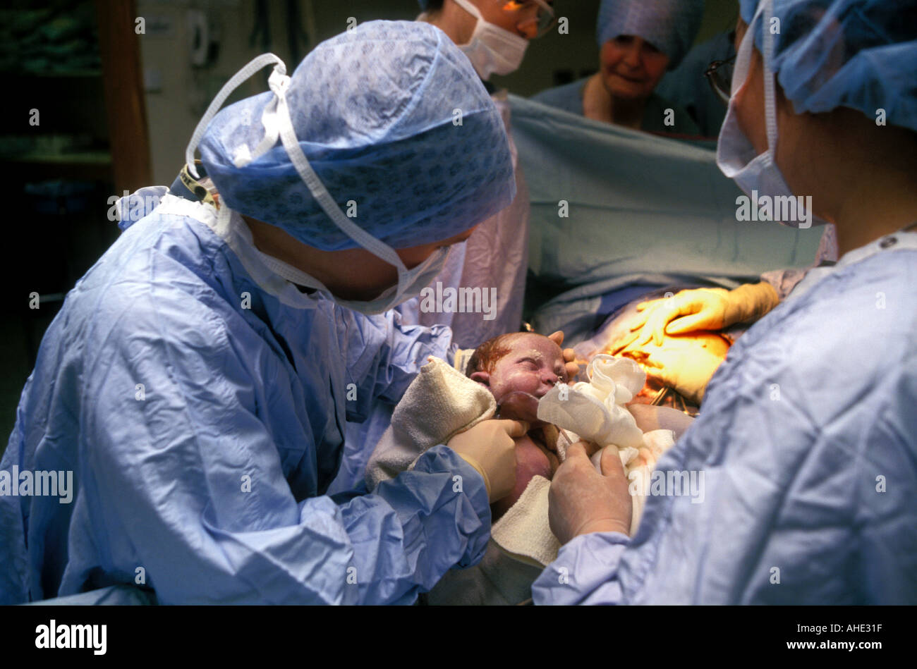 Baby sollevato dallo stomaco durante il taglio cesareo nascita Londra Foto Stock