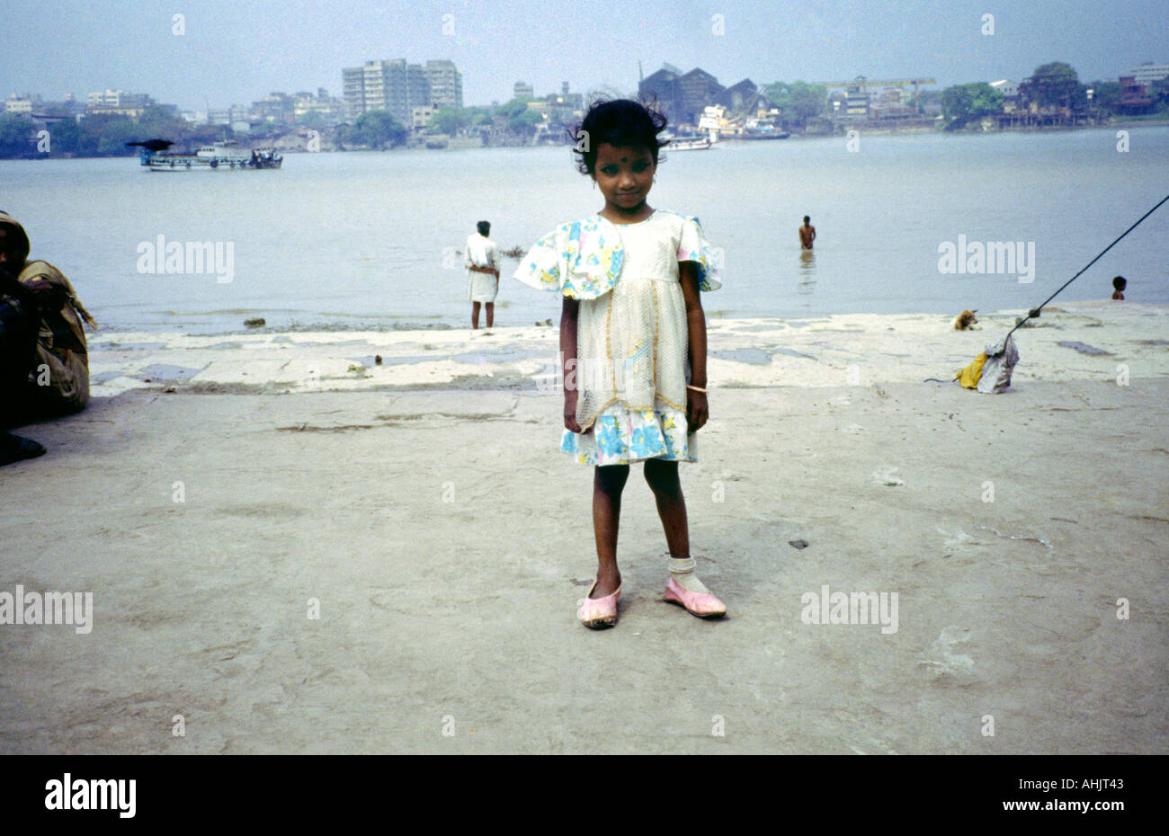 Calcutta India Nimtola Ghat bambino con il rachitismo Foto Stock