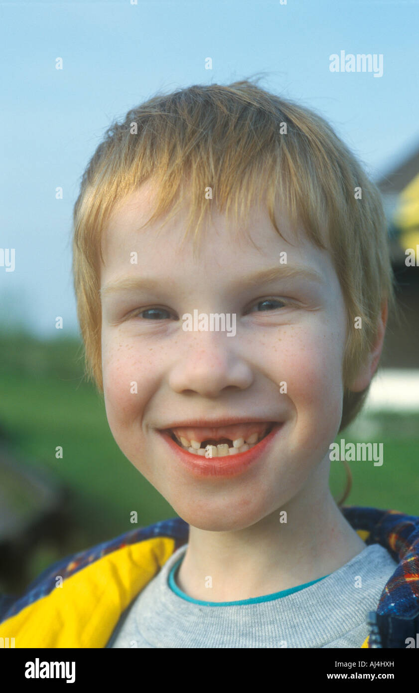 Ritratto di un sorridente ragazzo giovane con un grande divario di dente Foto Stock