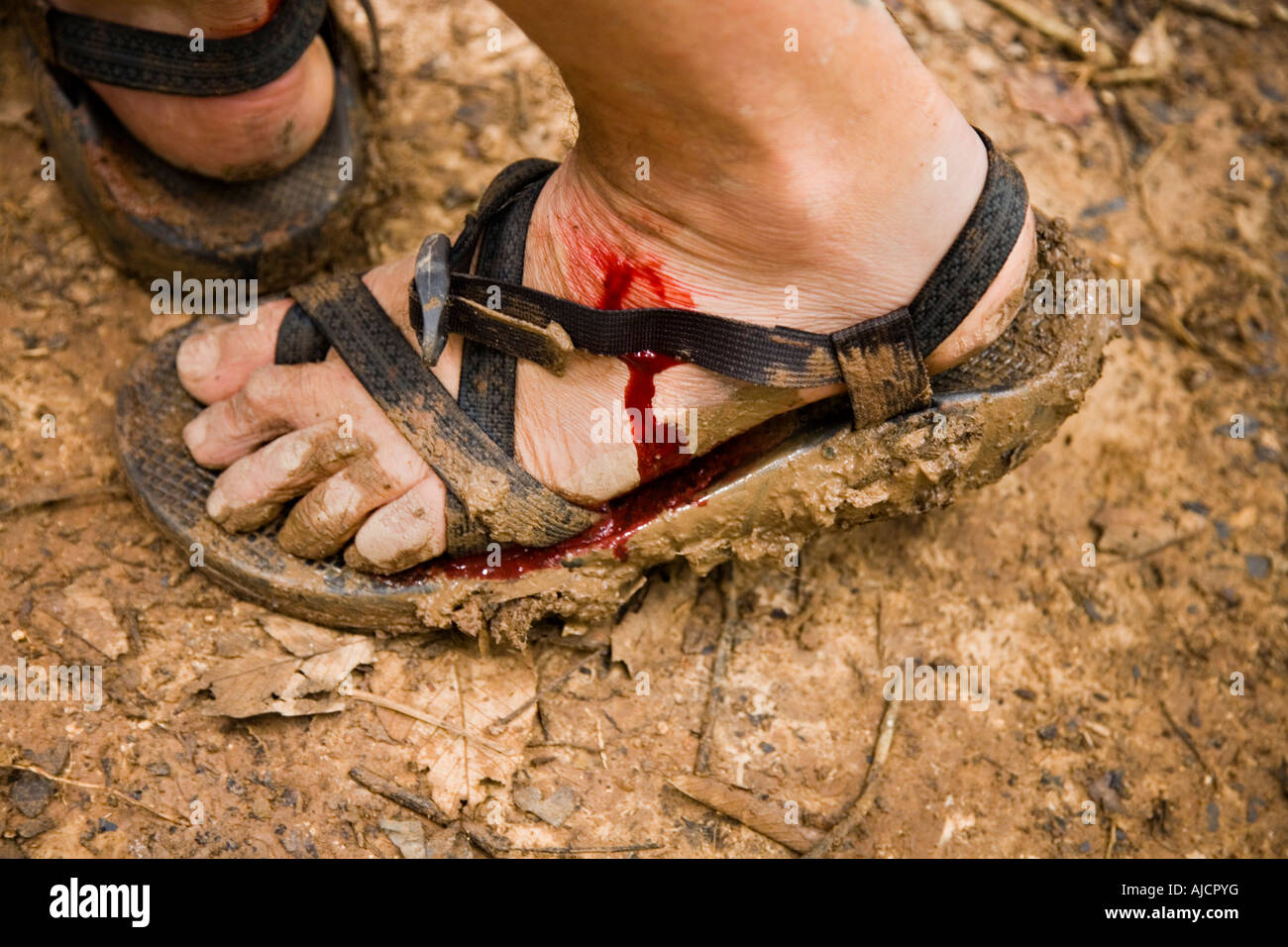Piede di un turista che sanguina dopo un morso di lech (liscivia), all'esperienza di Gibbon vicino Huay Xai sul fiume Mekong in Laos Foto Stock