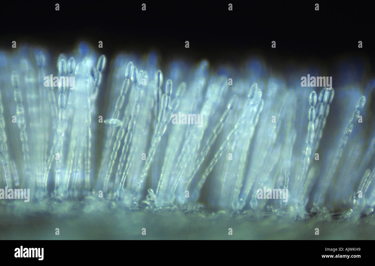 Polvere di muffa (Erysiphe graminis f.sp. Tritici) pustule e iphae su una foglia di grano Foto Stock