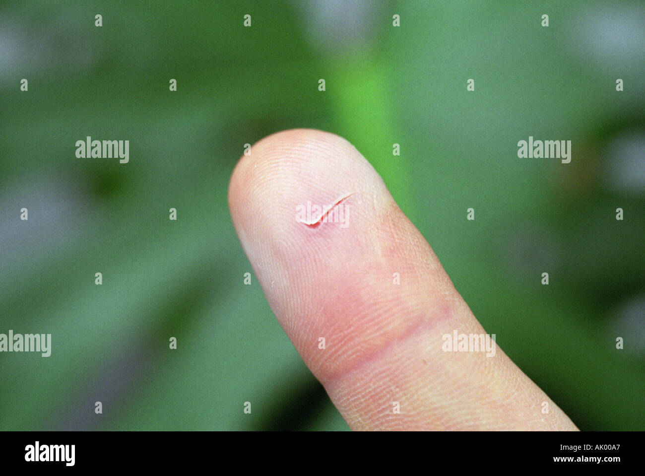 Logo Nike tagliato nella pelle di un dito Foto Stock