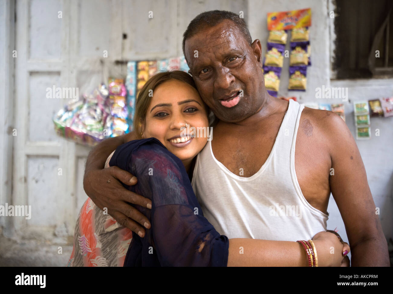 Un uomo indiano con un trattamento del viso difigurement Foto Stock