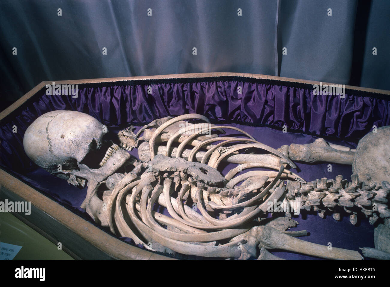Le ossa di Ursula Kemp Foto Stock
