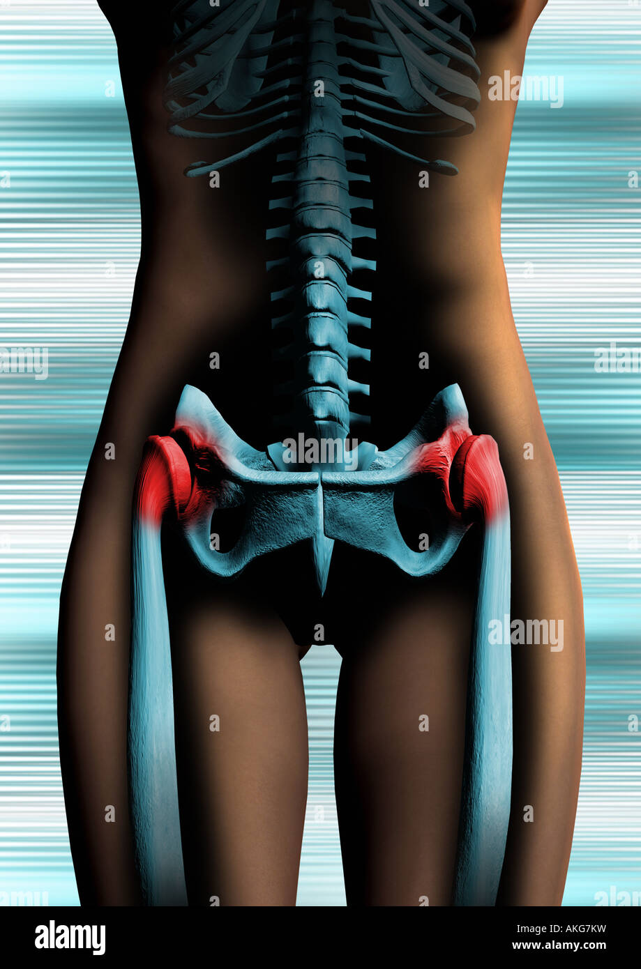 Donna hip bacino Frau Becken Huefte Foto Stock