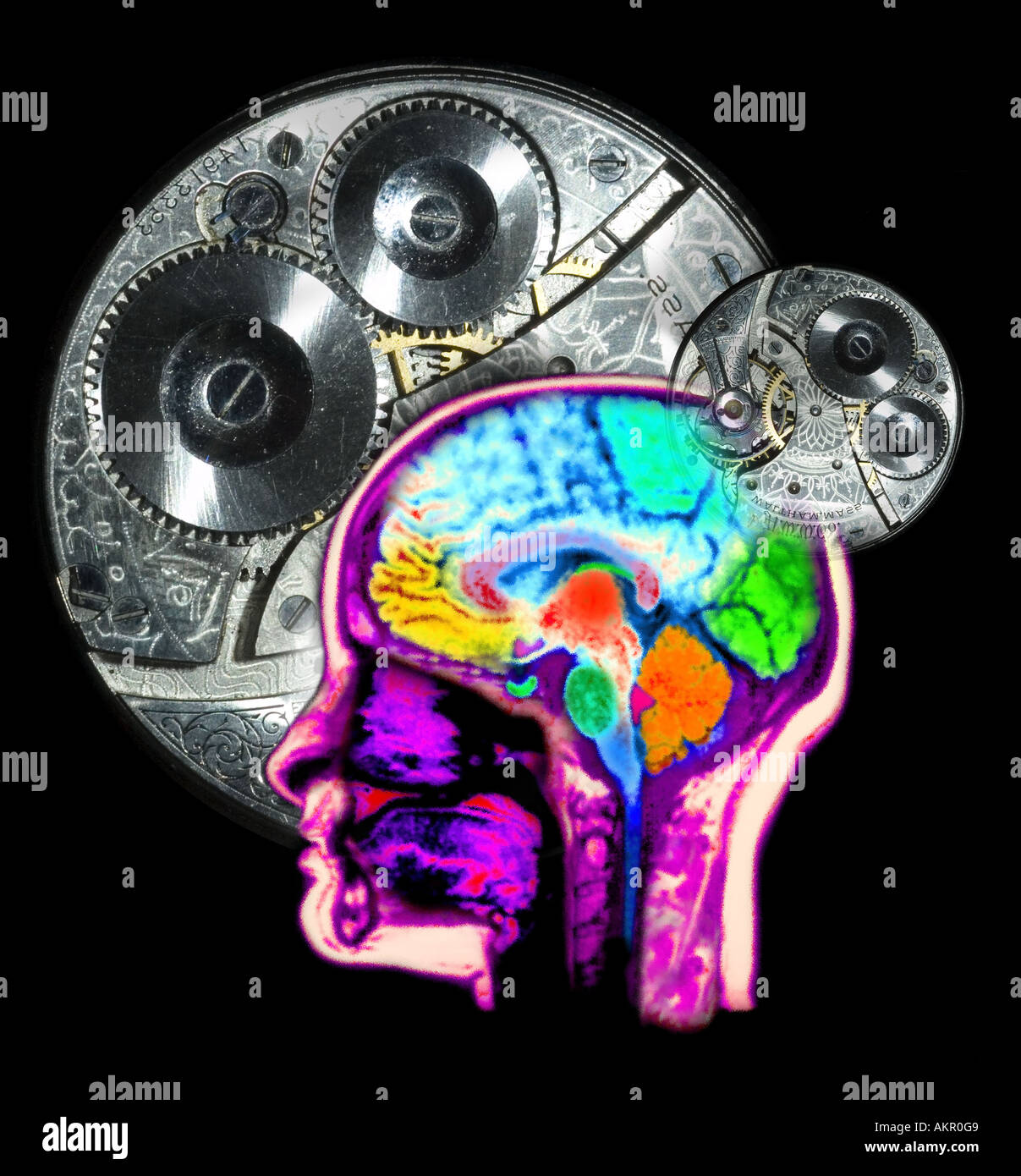 Risonanza magnetica MRI di scansione del computer di testata migliorato e colorato per mostrare la normale anatomia del cervello e la testa overlai Foto Stock