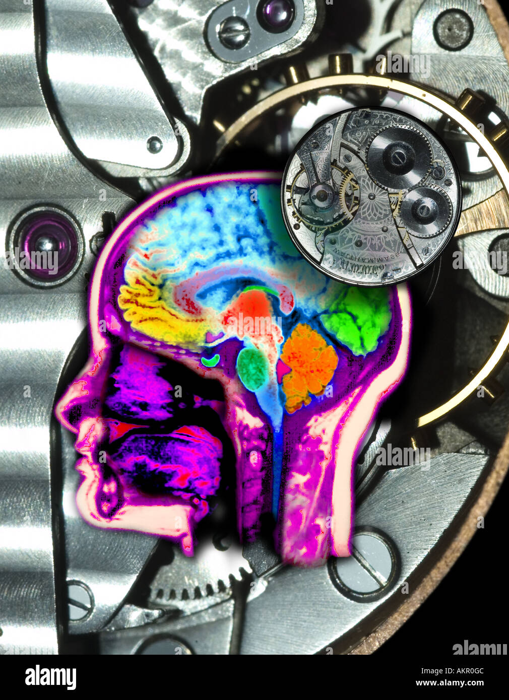 Risonanza magnetica MRI di scansione del computer di testata migliorato e colorato per mostrare la normale anatomia del cervello e la testa overlai Foto Stock