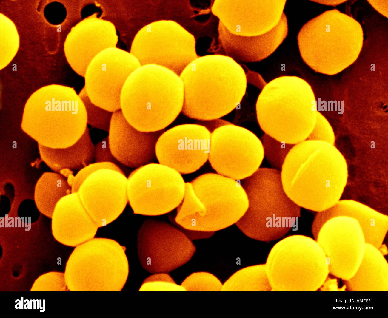 SEM - Staphylococcus aureus Foto Stock