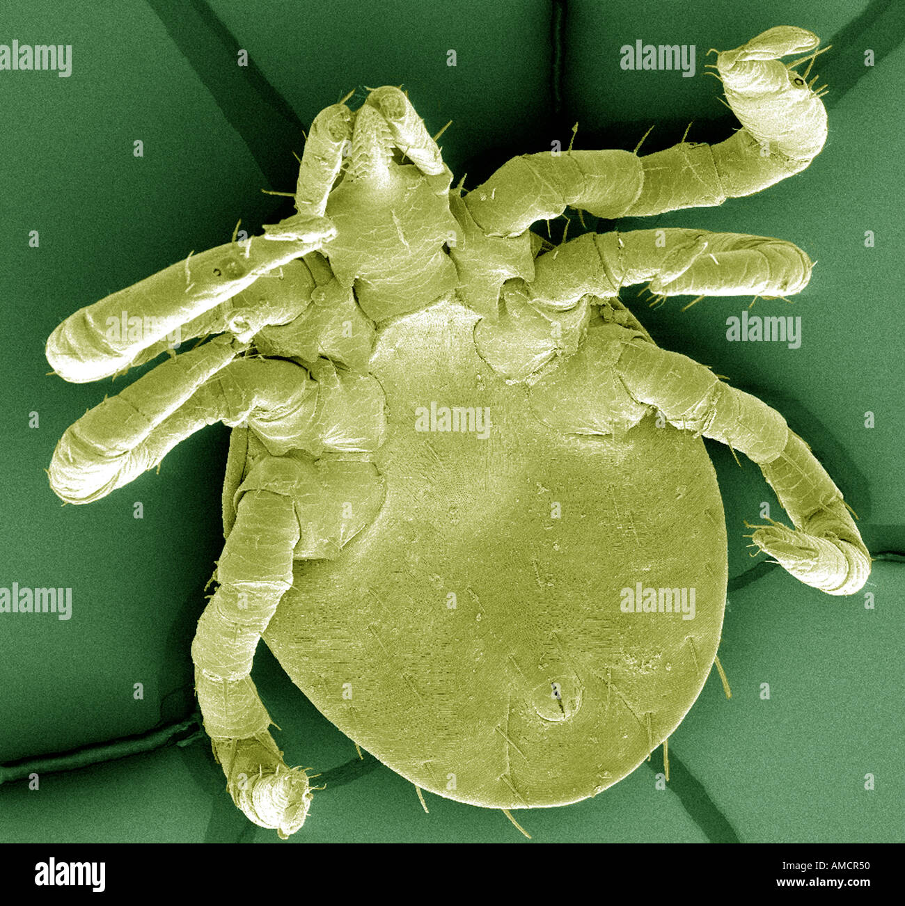 Una micrografia elettronica a scansione di una artropodi, ingrandite x96 Foto Stock