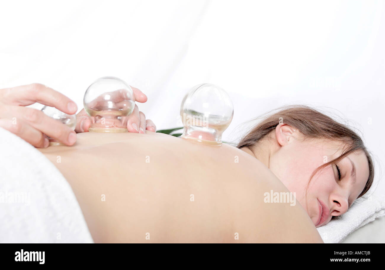 Giovane donna giaceva sul letto ricevente di agopuntura coppettazione Foto Stock