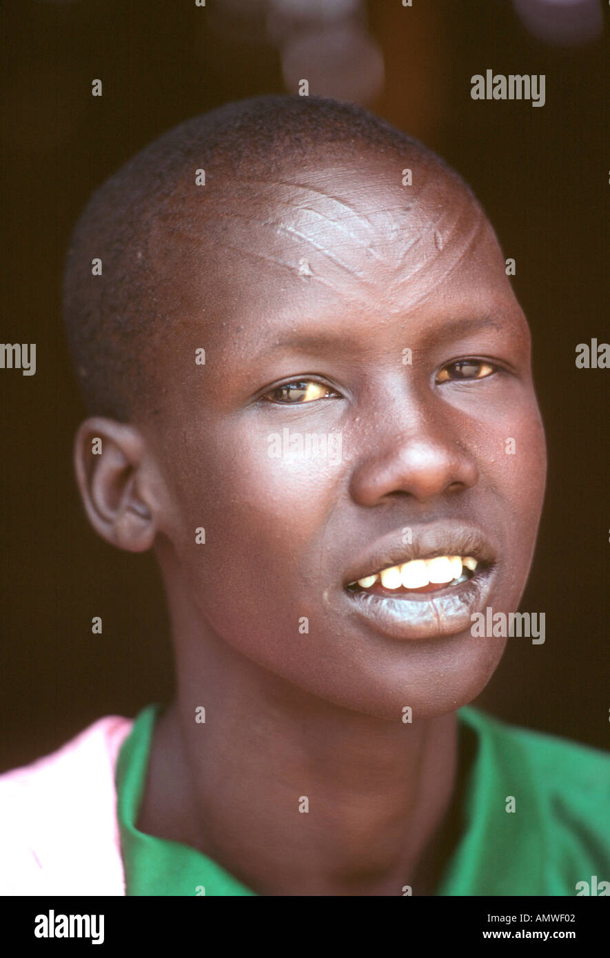 Nel Sudan meridionale un Dinka la gioventù è leggermente marcata con cicatrici tribali sulla sua fronte Foto Stock