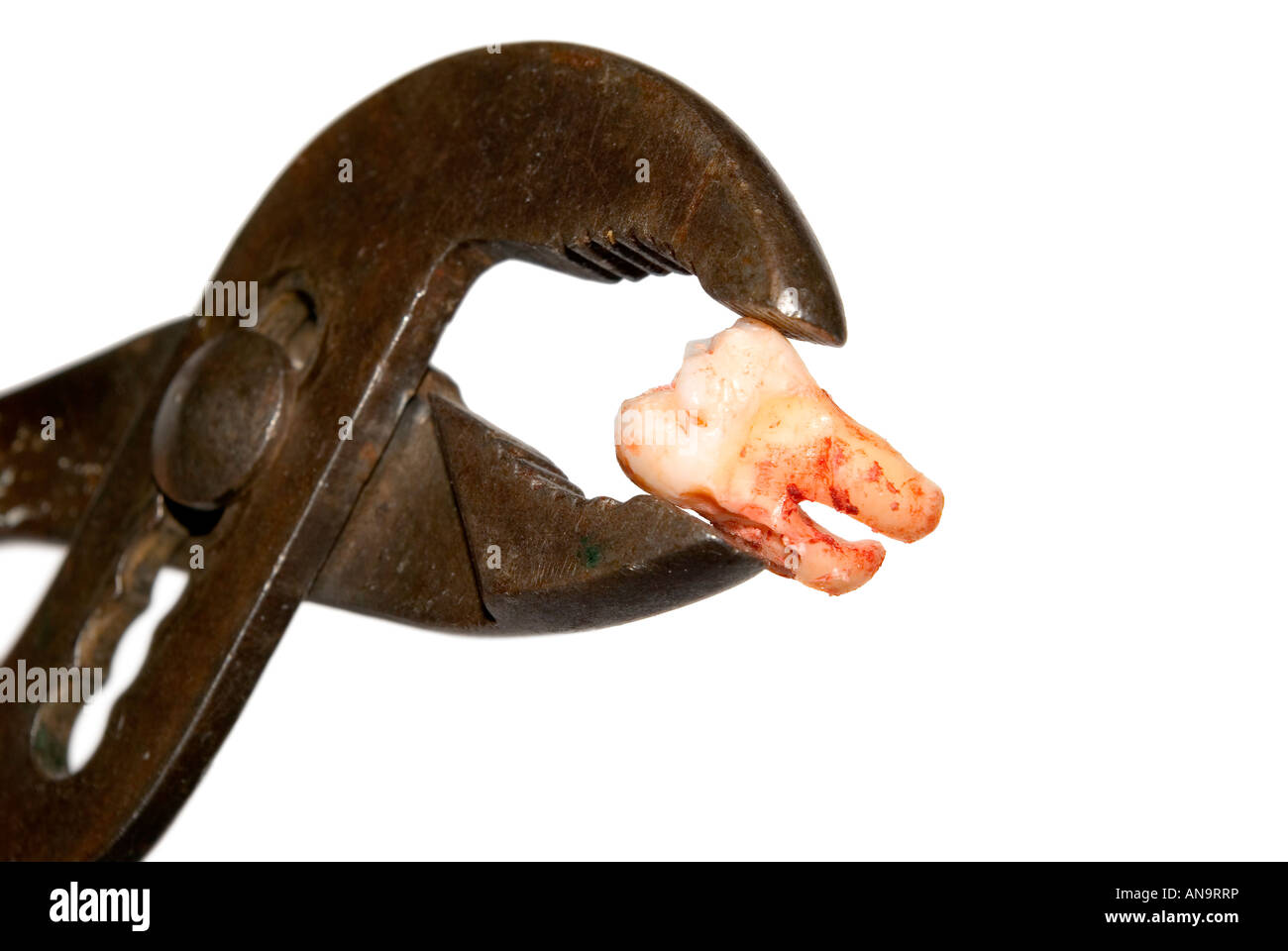 Bloody dente rimosso con una pinza arrugginito Foto Stock
